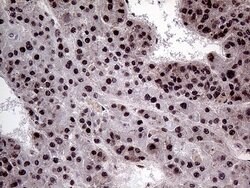 Invitrogen PPP4C Monoclonal Antibody (OTI2E4) 100 &mu;L; Unconjugated:Antibodies,
