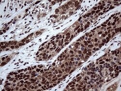 Invitrogen PPP4C Monoclonal Antibody (OTI2E4) 100 &mu;L; Unconjugated:Antibodies,