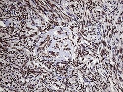 Invitrogen PPP4C Monoclonal Antibody (OTI2E4) 100 &mu;L; Unconjugated:Antibodies,
