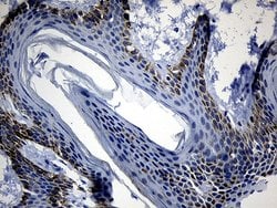 Invitrogen DHRS4L2 Monoclonal Antibody (OTI8D1) 100 &mu;L; Unconjugated:Antibodies,