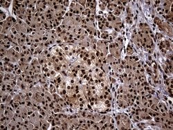 Invitrogen PSMA7 Monoclonal Antibody (OTI5F6) 100 &mu;L; Unconjugated:Antibodies,