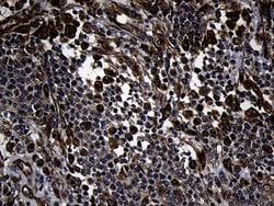 Invitrogen FBXO25 Monoclonal Antibody (OTI6F11) 100 &mu;L; Unconjugated:Antibodies,