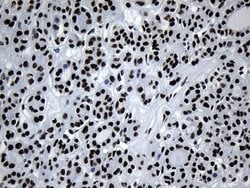 Invitrogen MED19 Monoclonal Antibody (OTI2D1) 100 &mu;L; Unconjugated:Antibodies,