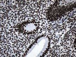 Invitrogen MED19 Monoclonal Antibody (OTI2D1) 100 &mu;L; Unconjugated:Antibodies,