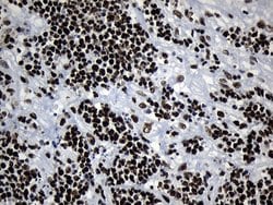 Invitrogen MED19 Monoclonal Antibody (OTI2D1) 100 &mu;L; Unconjugated:Antibodies,