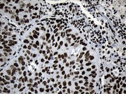 Invitrogen MED19 Monoclonal Antibody (OTI2D1) 100 &mu;L; Unconjugated:Antibodies,
