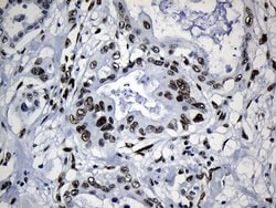Invitrogen MED19 Monoclonal Antibody (OTI2D1) 100 &mu;L; Unconjugated:Antibodies,