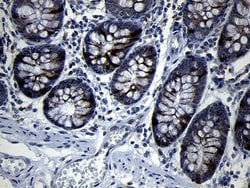 Invitrogen RRM2 Monoclonal Antibody (OTI1F2) 100 &mu;L; Unconjugated:Antibodies,