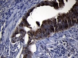 Invitrogen RRM2 Monoclonal Antibody (OTI1F2) 100 &mu;L; Unconjugated:Antibodies,