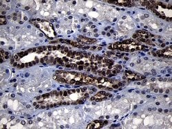 Invitrogen RRM2 Monoclonal Antibody (OTI1F2) 100 &mu;L; Unconjugated:Antibodies,