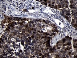 Invitrogen RRM2 Monoclonal Antibody (OTI1F2) 100 &mu;L; Unconjugated:Antibodies,