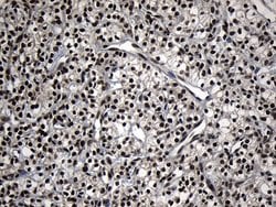 ZNF583 Monoclonal Antibody (OTI4D2):Antibodies, Monoclonal