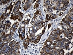 Invitrogen CPT1B Monoclonal Antibody (OTI2A6) 100 &mu;L; Unconjugated:Antibodies,