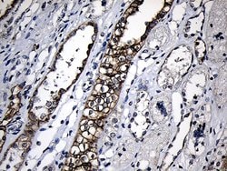 Invitrogen CPT1B Monoclonal Antibody (OTI2A6) 100 &mu;L; Unconjugated:Antibodies,