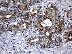 Invitrogen CPT1B Monoclonal Antibody (OTI2A6) 100 &mu;L; Unconjugated:Antibodies,