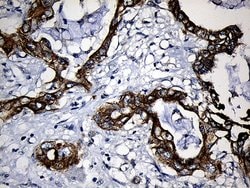 Invitrogen CPT1B Monoclonal Antibody (OTI2A6) 100 &mu;L; Unconjugated:Antibodies,