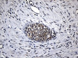 Invitrogen CPT1B Monoclonal Antibody (OTI2A6) 100 &mu;L; Unconjugated:Antibodies,