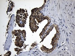 Invitrogen CPT1B Monoclonal Antibody (OTI2A6) 100 &mu;L; Unconjugated:Antibodies,