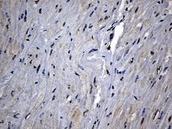 Invitrogen CPT1B Monoclonal Antibody (OTI2A6) 100 &mu;L; Unconjugated:Antibodies,