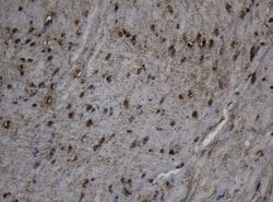 Invitrogen CPT1B Monoclonal Antibody (OTI6B8) 100 &mu;L; Unconjugated:Antibodies,