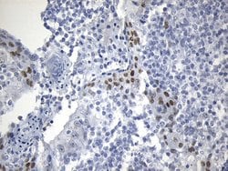 OIP5 Monoclonal Antibody (OTI1F1):Antibodies, Monoclonal