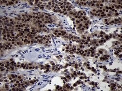 Invitrogen OIP5 Monoclonal Antibody (OTI1D12) 100 &mu;L; Unconjugated:Antibodies,