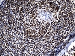 ZHX2 Monoclonal Antibody (OTI2E11), Invitrogen 100 &mu;L; Unconjugated:Antibodies,