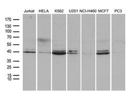 Invitrogen IkB epsilon Monoclonal Antibody (OTI4D1) 100 &mu;L; Unconjugated:Antibodies,