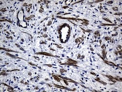 Invitrogen MYL1 Monoclonal Antibody (OTI1H3) 100 &mu;L; Unconjugated:Antibodies,