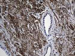 Invitrogen MYL1 Monoclonal Antibody (OTI1H3) 100 &mu;L; Unconjugated:Antibodies,