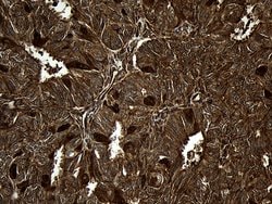 Invitrogen MYL1 Monoclonal Antibody (OTI1D9) 100 &mu;L; Unconjugated:Antibodies,