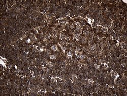 Invitrogen MYL1 Monoclonal Antibody (OTI1D9) 100 &mu;L; Unconjugated:Antibodies,
