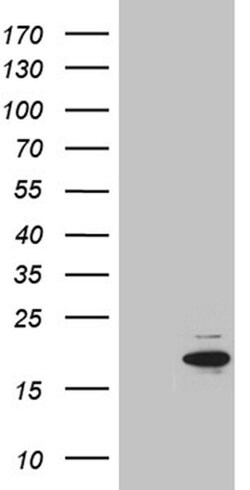 Invitrogen MYL1 Monoclonal Antibody (OTI1D9) 100 &mu;L; Unconjugated:Antibodies,