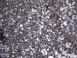 Invitrogen ZNF705D Monoclonal Antibody (OTI1G1) 100 &mu;L; Unconjugated:Antibodies,