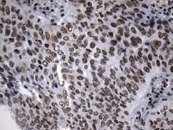 Invitrogen ZNF705D Monoclonal Antibody (OTI1G1) 100 &mu;L; Unconjugated:Antibodies,