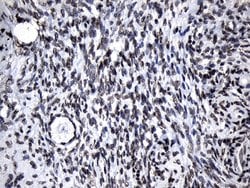 Invitrogen ZNF705D Monoclonal Antibody (OTI1G1) 100 &mu;L; Unconjugated:Antibodies,