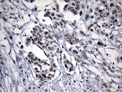 Invitrogen ZNF705D Monoclonal Antibody (OTI1G1) 100 &mu;L; Unconjugated:Antibodies,