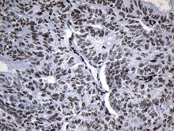Invitrogen ZNF705D Monoclonal Antibody (OTI1G1) 100 &mu;L; Unconjugated:Antibodies,