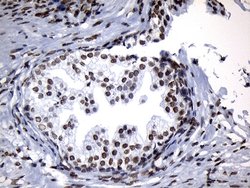 Invitrogen ZNF705D Monoclonal Antibody (OTI1G1) 100 &mu;L; Unconjugated:Antibodies,