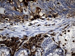 Invitrogen PLAC8 Monoclonal Antibody (OTI2E10) 100 &mu;L; Unconjugated:Antibodies,