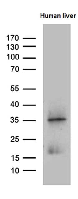 Invitrogen PLAC8 Monoclonal Antibody (OTI2E10) 100 &mu;L; Unconjugated:Antibodies,
