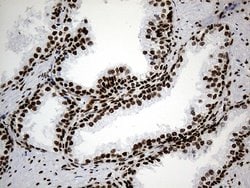 Invitrogen hnRNP H1 Monoclonal Antibody (OTI2E8) 100 &mu;L; Unconjugated:Antibodies,