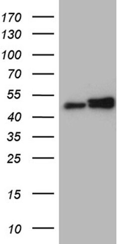 Invitrogen hnRNP H1 Monoclonal Antibody (OTI2E8) 100 &mu;L; Unconjugated:Antibodies,
