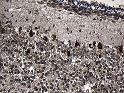 Invitrogen TCP-1 delta Monoclonal Antibody (OTI4C9) 100 &mu;L | Buy Online | Invitrogen&trade; | Fisher Scientific