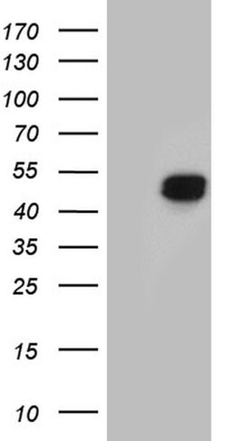 Invitrogen HOXD8 Monoclonal Antibody (OTI2A1) 100 &mu;L; Unconjugated:Antibodies,