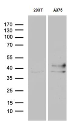 Invitrogen HOXD8 Monoclonal Antibody (OTI2A1) 100 &mu;L; Unconjugated:Antibodies,