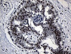 Invitrogen ZKSCAN1 Monoclonal Antibody (OTI2C9) 100 &mu;L; Unconjugated:Antibodies,