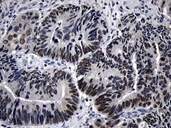 Invitrogen ZKSCAN1 Monoclonal Antibody (OTI2C9) 100 &mu;L; Unconjugated:Antibodies,