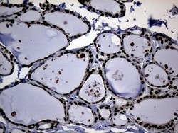 Invitrogen ASH2L Monoclonal Antibody (OTI7D11) 100 &mu;L; Unconjugated:Antibodies,