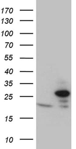 Invitrogen TIMM23 Monoclonal Antibody (OTI2F5) 100 &mu;L; Unconjugated:Antibodies,